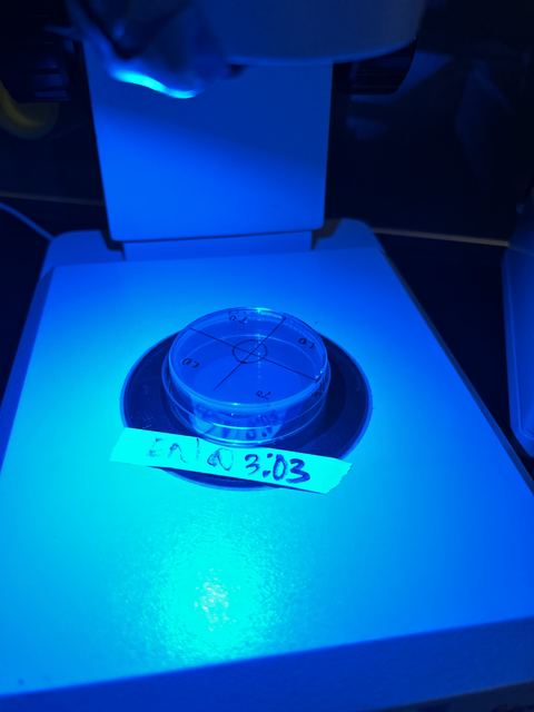 Lab shot of a single petri dish on a microscope stage bathed in blue light, with a handwritten tape label (appears to read a sample ID/time)